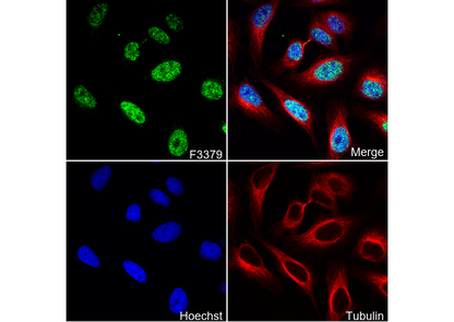 Fos B Antibody
