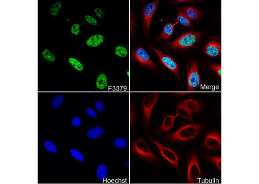 Fos B Antibody