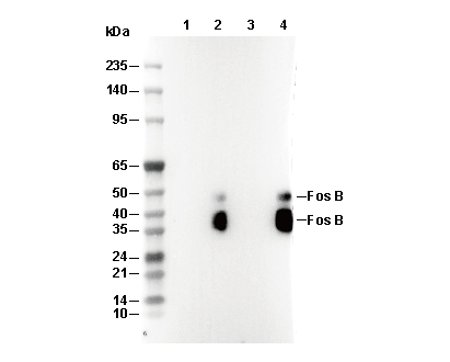 Fos B Antibody