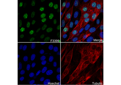 Histone H3 (di methyl Lys36) Antibody