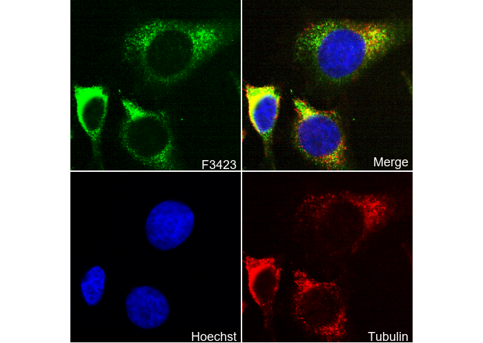 Galactosidase α Antibody