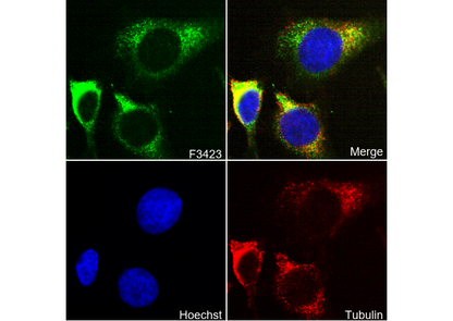 Galactosidase α Antibody