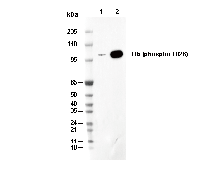 Phospho-Rb (Thr826) Antibody