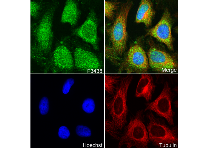 MetRS/MARS Antibody