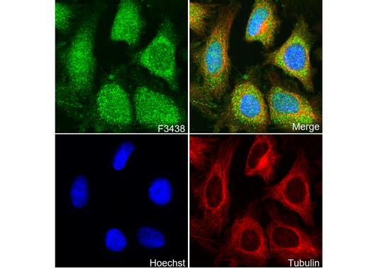 MetRS/MARS Antibody
