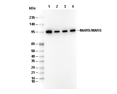 MetRS/MARS Antibody
