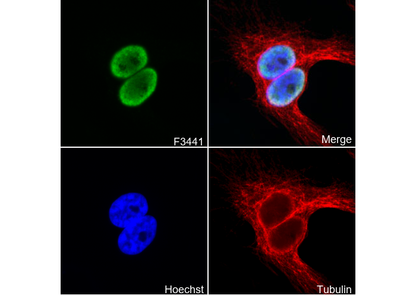 EWSR1/EWS Antibody