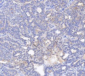 MUC16 Antibody