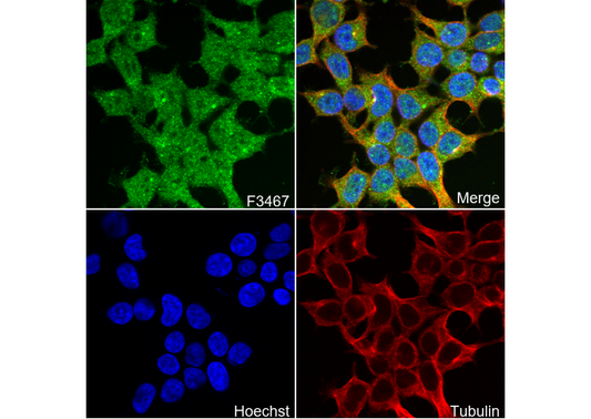 ATP6V1B1 + ATP6V1B2 Antibody