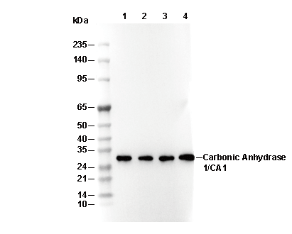 Carbonic Anhydrase 1/CA1 Antibody