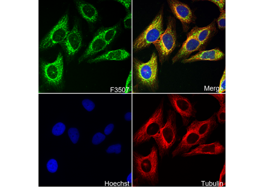 Phospho-Akt (Ser473) Antibody