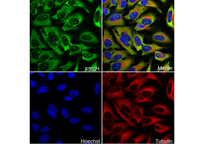 S6 Ribosomal Protein Antibody