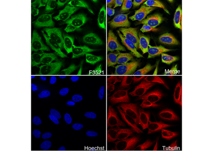 S6 Ribosomal Protein Antibody