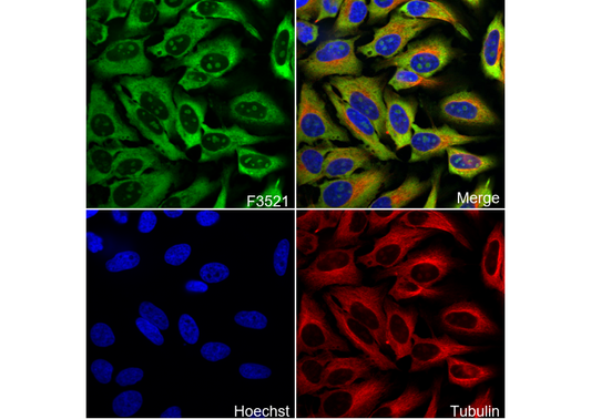 S6 Ribosomal Protein Antibody