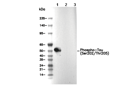 Phospho-Tau (Ser202/Thr205) Antibody