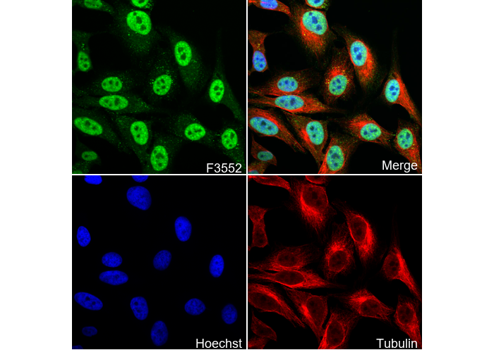 Phospho-CDK2 (Thr160) Antibody