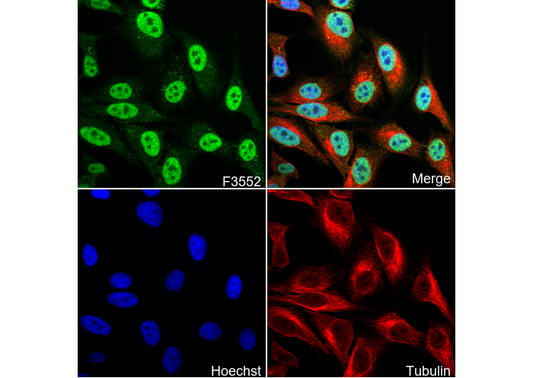 Phospho-CDK2 (Thr160) Antibody