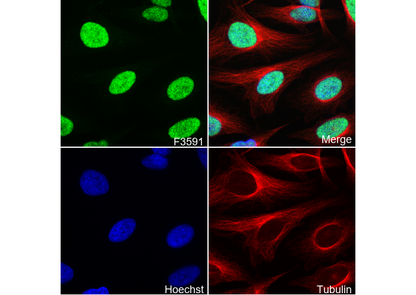 Chk2 Antibody