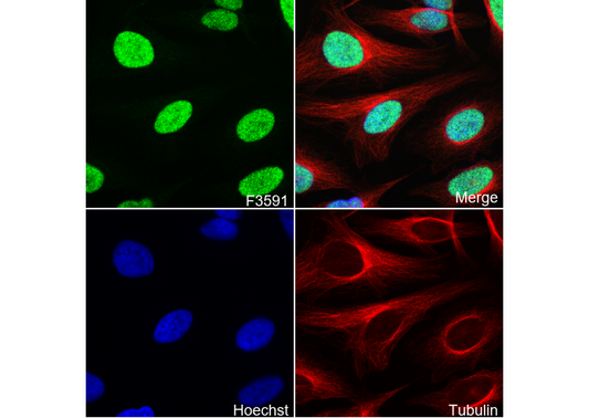 Chk2 Antibody