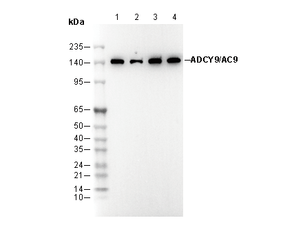 ADCY9 / AC9 Antibody