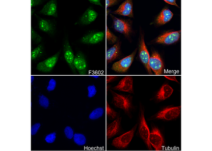 PARN Antibody