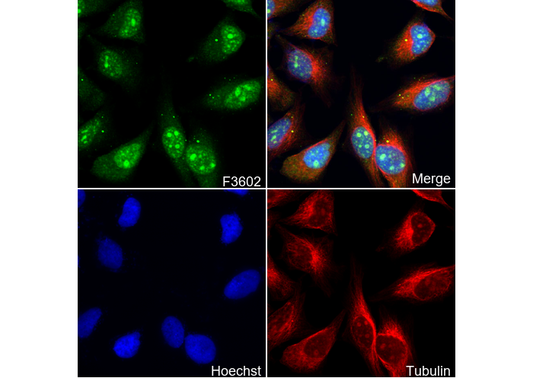 PARN Antibody