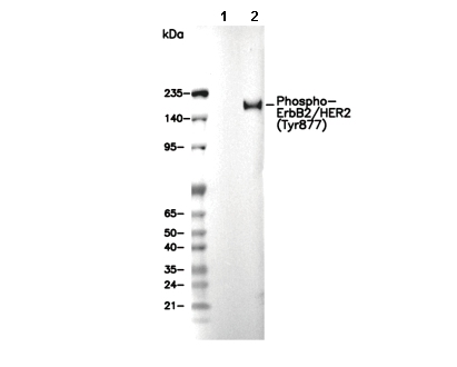 Phospho-ErbB2/HER2 (Tyr877) Antibody