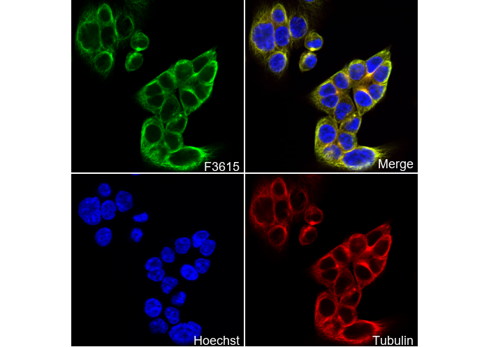 Aspartate Aminotransferase + FABP-1 Antibody