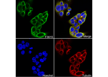 Aspartate Aminotransferase + FABP-1 Antibody