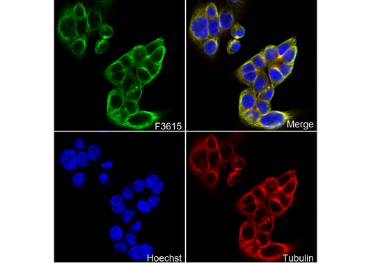 Aspartate Aminotransferase + FABP-1 Antibody