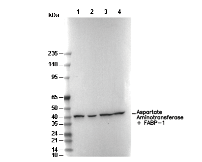 Aspartate Aminotransferase + FABP-1 Antibody