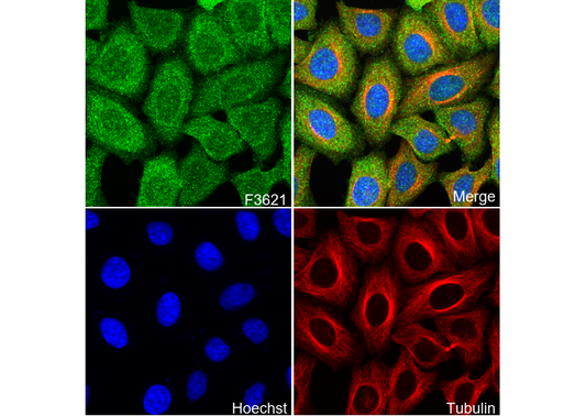 PPP1CA + PPP1CB Antibody
