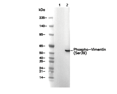 Phospho-Vimentin (Ser39) Antibody