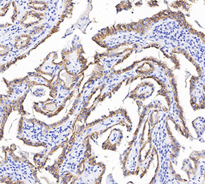 TSH Receptor/TSH-R Antibody