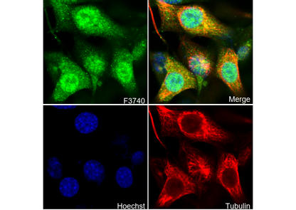 Phospho-Smad2 (Ser467) Antibody