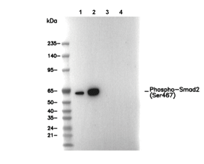 Phospho-Smad2 (Ser467) Antibody