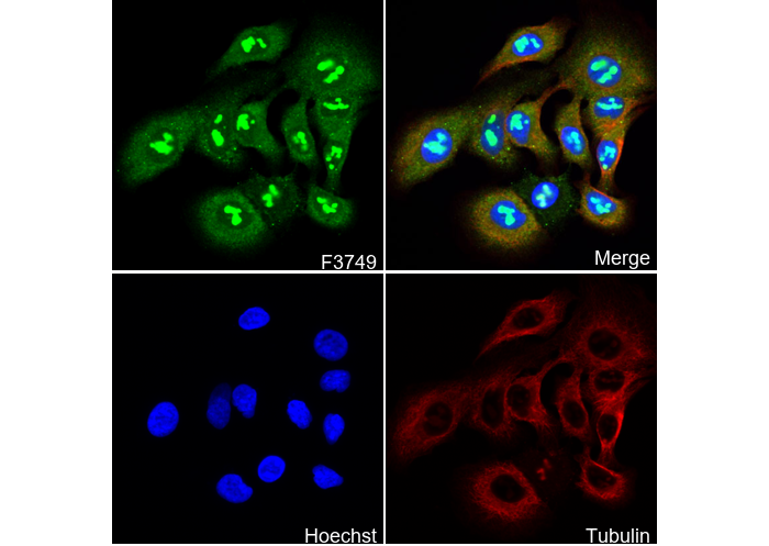 GAD65 + GAD67 Antibody