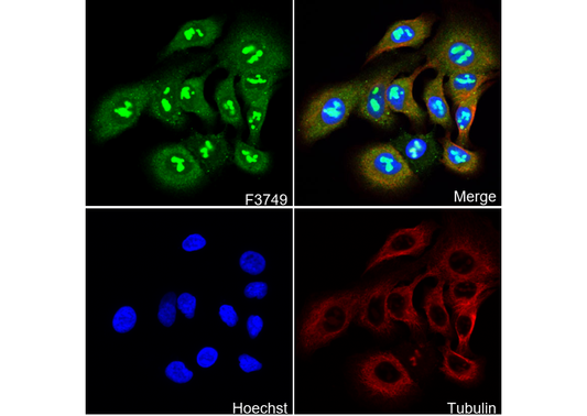 GAD65 + GAD67 Antibody