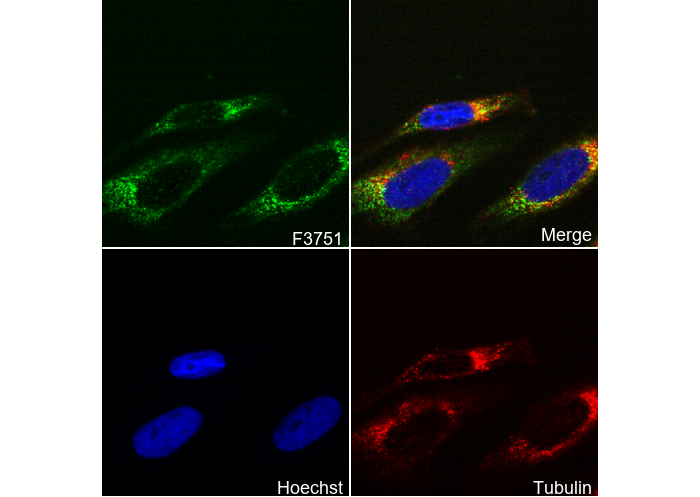 CPT1A Antibody