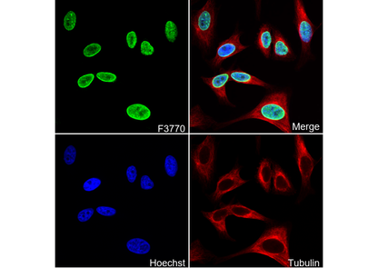 HMGA2 Antibody
