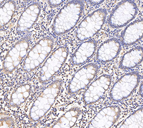 CaV1.3 Antibody