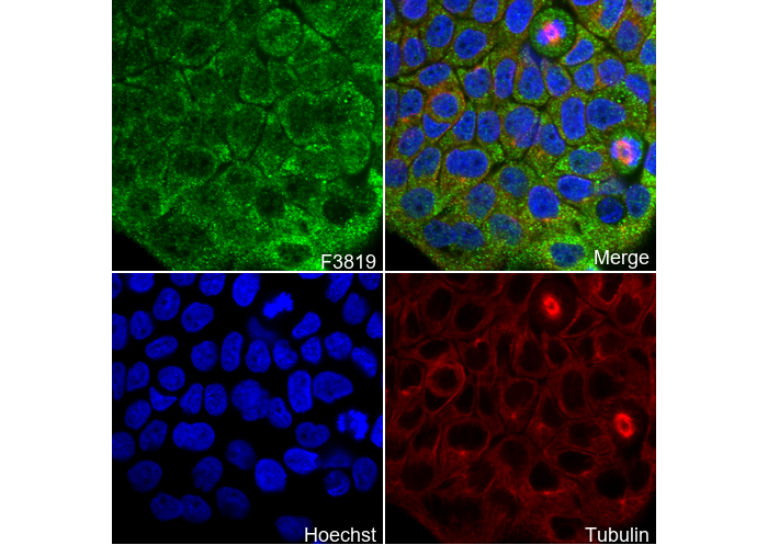 Cardiac Troponin T Antibody