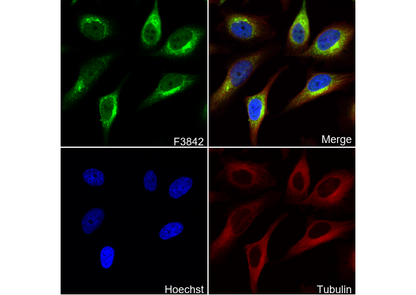 PKA R2/PKR2 Antibody
