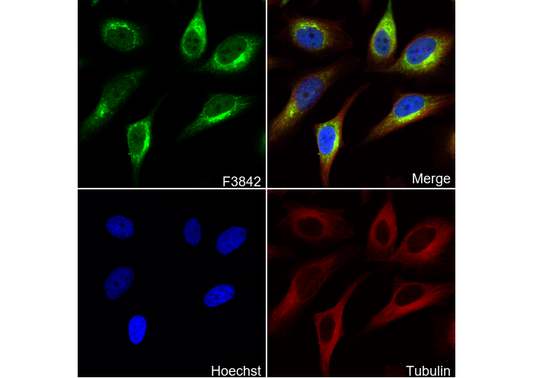 PKA R2/PKR2 Antibody