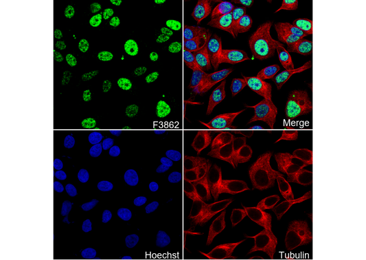 SAE1 Antibody