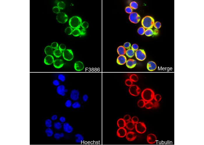 NDRG1 Antibody