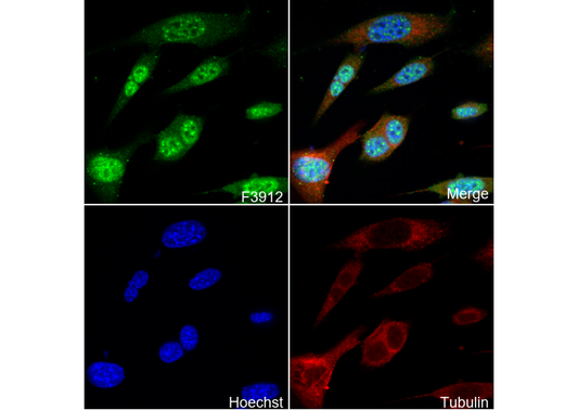 Phospho-JNK (Thr183) Antibody