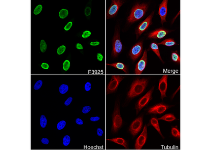 Histone H4K20me2 (di methyl Lys20) Antibody