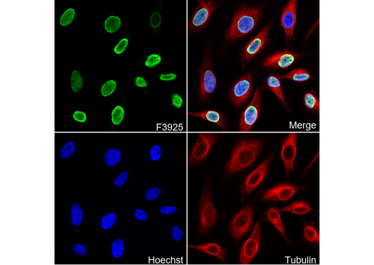 Histone H4K20me2 (di methyl Lys20) Antibody
