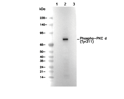Phospho-PKC δ (Tyr311) Antibody